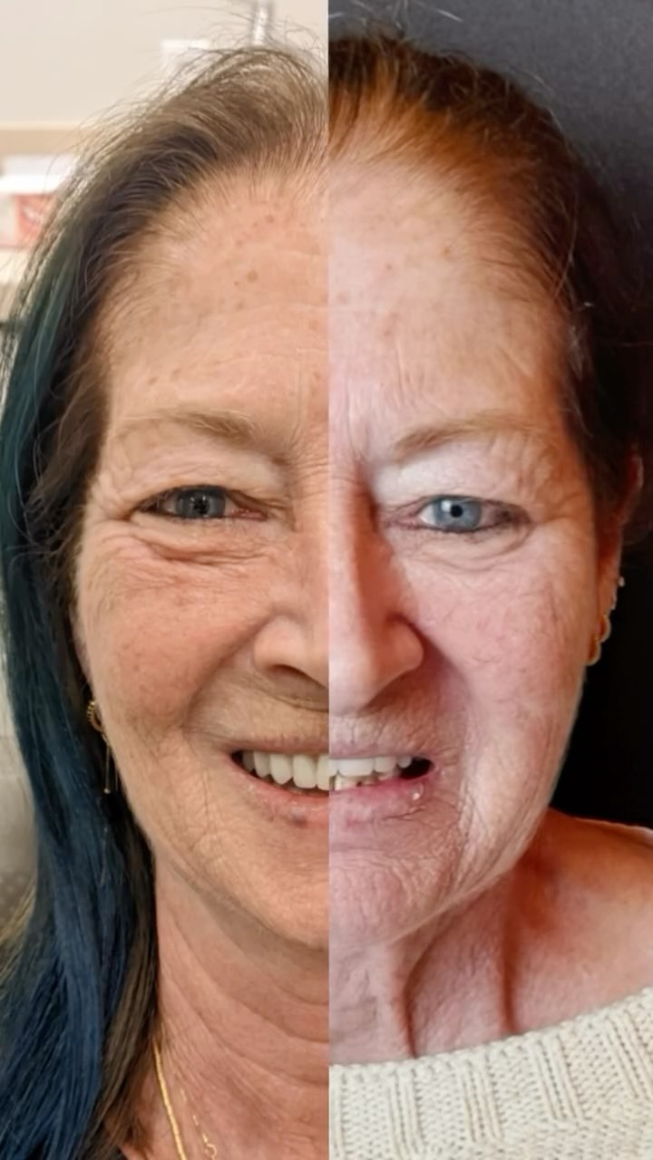 Comparativo antes e depois de reabilitação estética