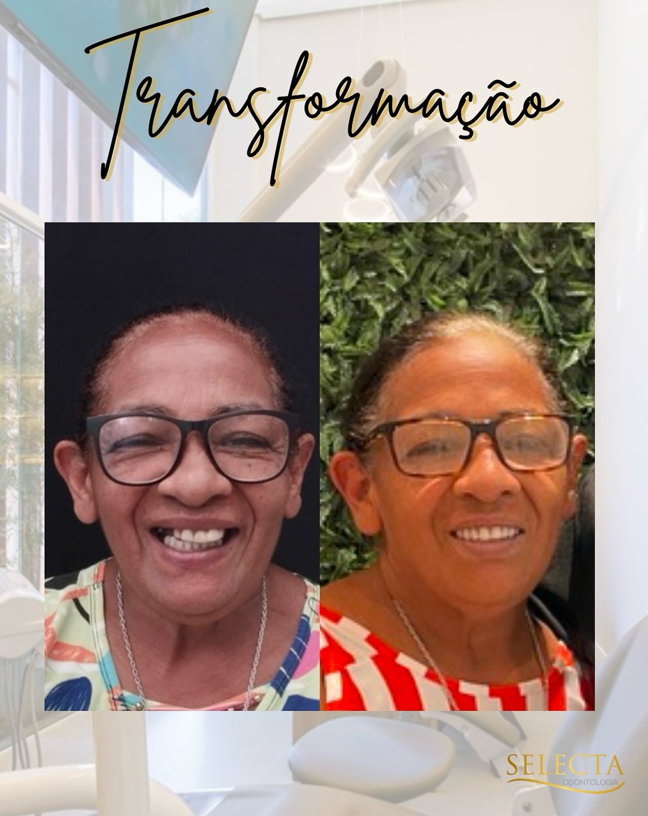 Transformação de sorriso — reabilitação oral completa